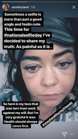 Sarah Hyland van het moderne gezin is in het ziekenhuis opgenomen en deelt een pijnlijke selfie van haar gezwollen gezicht